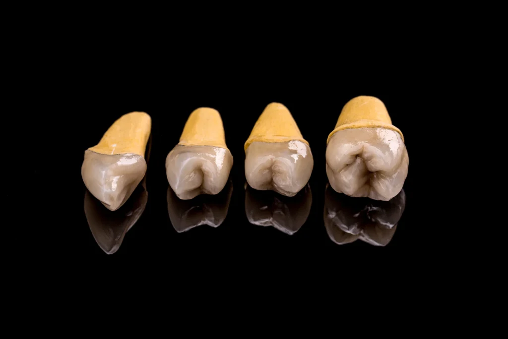 prosthetic teeth showing tooth cavity